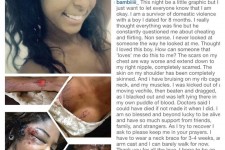 Victim of Domestic Abuse "Bambiii" that went viral