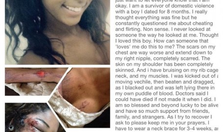 Victim of Domestic Abuse "Bambiii" that went viral